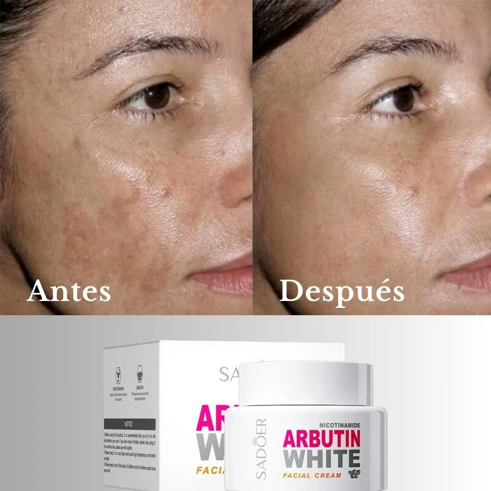 LA CREMA ANTIMANCHAS # 1 ORIGINAL 😍 Aclara, Hidrata y Rejuvenece - Oferta 2x1 🔥